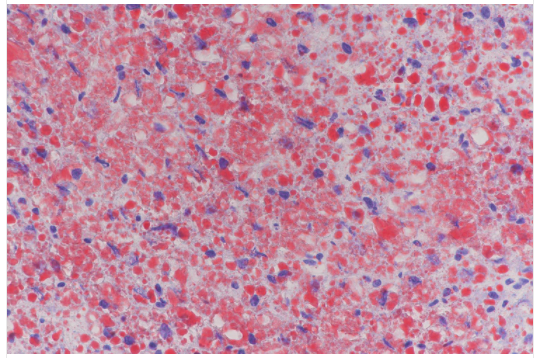 cancer biomarkers guide