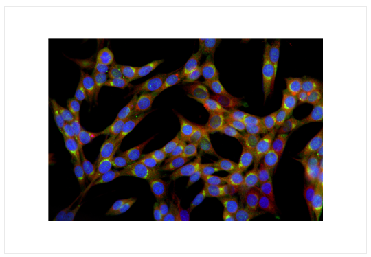 cancer biomarkers guide