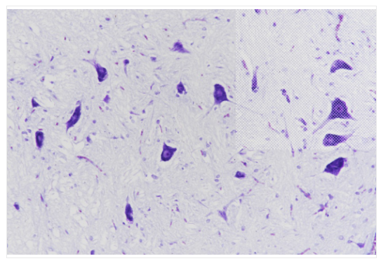 cancer biomarkers guide