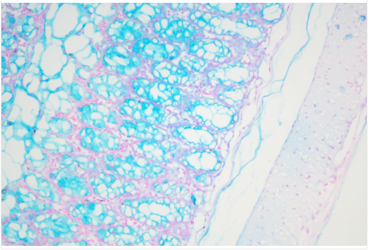 cancer biomarkers guide