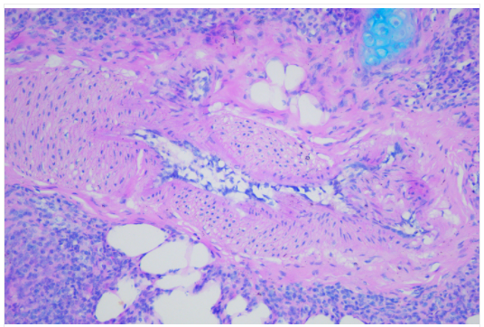 cancer biomarkers guide