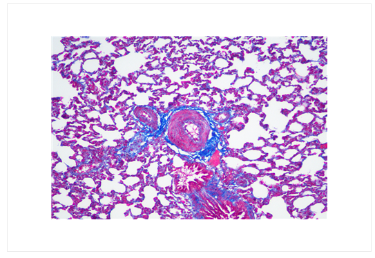 cancer biomarkers guide